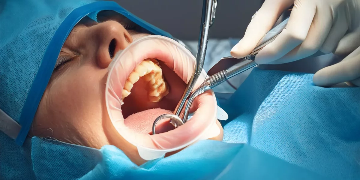 Zihinsel Engelli Hastalarda Diş Çekimi