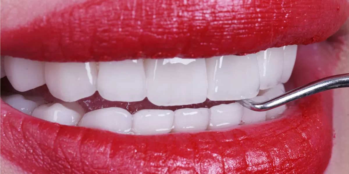 Hollywood Smile Türkiye: Bir Ağız Cerrahı Tarafından Çürütülen 7 Efsane