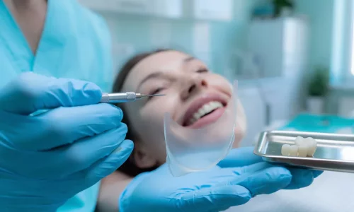 Veneerlar İçin Diş Tıraşı: Gerekli Mi? - Milim Dental Hospital