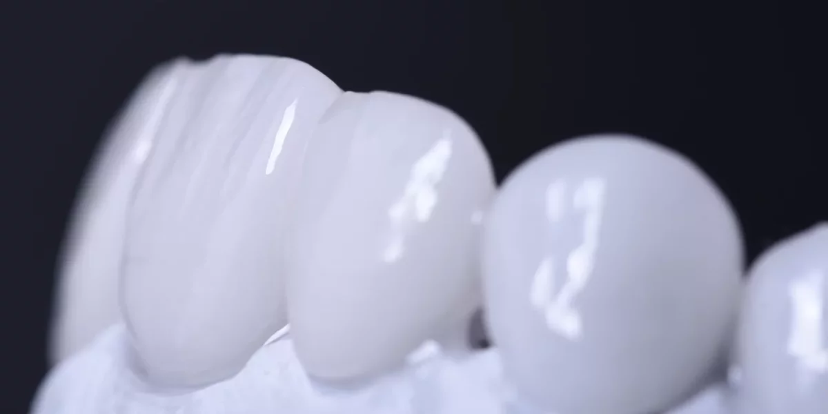 Emax ve Zirconia: Günışığında Hangisi Daha Doğal Görünür? (Hollanda Perspektifi)