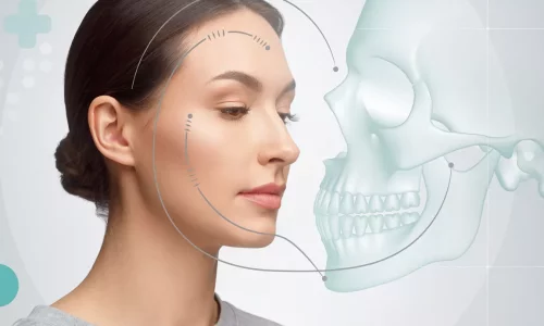 Çene daralmasının belirtileri nelerdir? - Milim Dental Hospital
