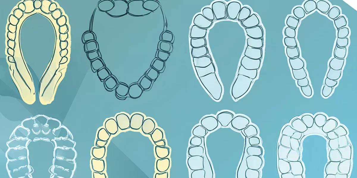 Tüm Şeffaf Plak Markaları Aynı mı?