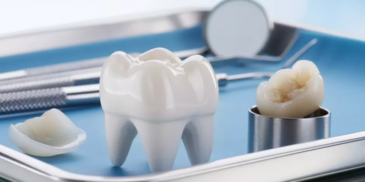 Uzun Vadeli Bakım (Veneers & Crowns)