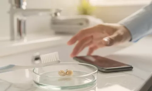 Eve Döndükten Sonra Bir Kaplama Çip Olursa Ne Yapmalı - Milim Dental Hospital