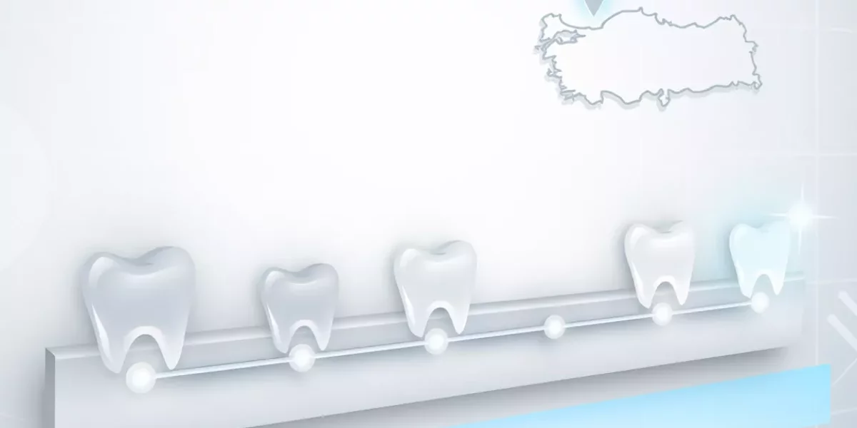 Türkiye'de Veneer Zaman Çizelgesi