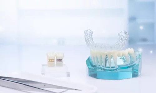 Tutucuların rolü nedir? - Milim Dental Hospital