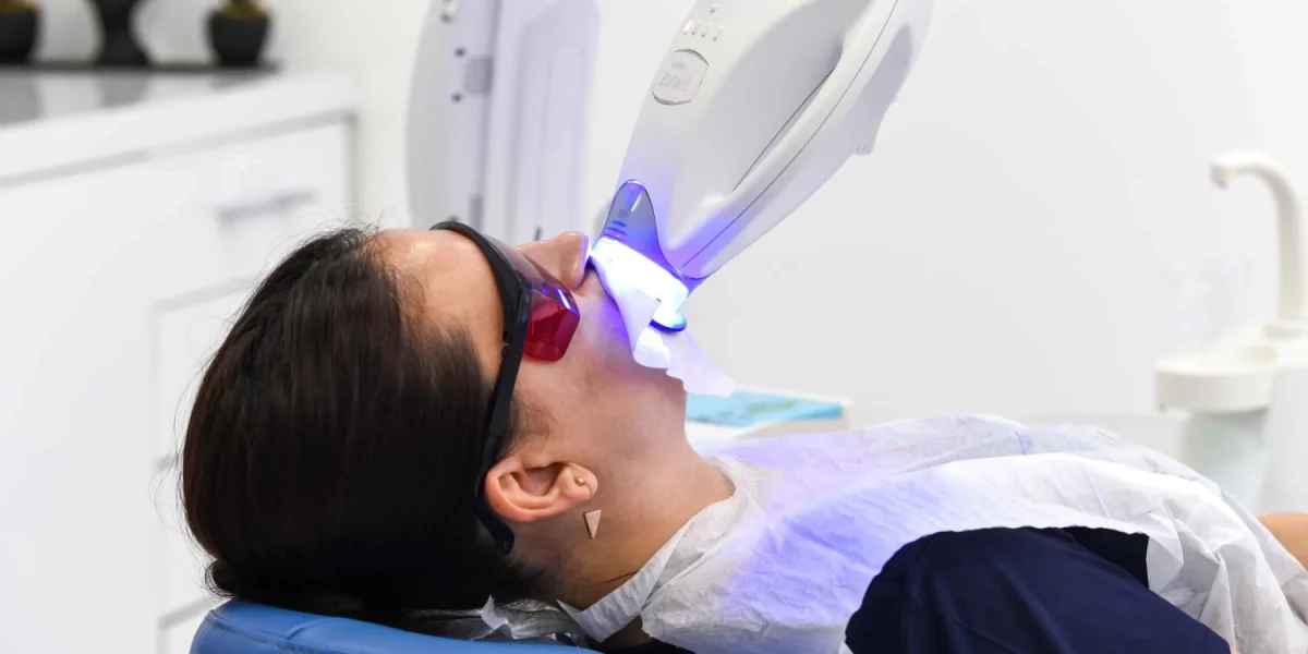 Diş Beyazlatma Nedir ve Neden Gereklidir?