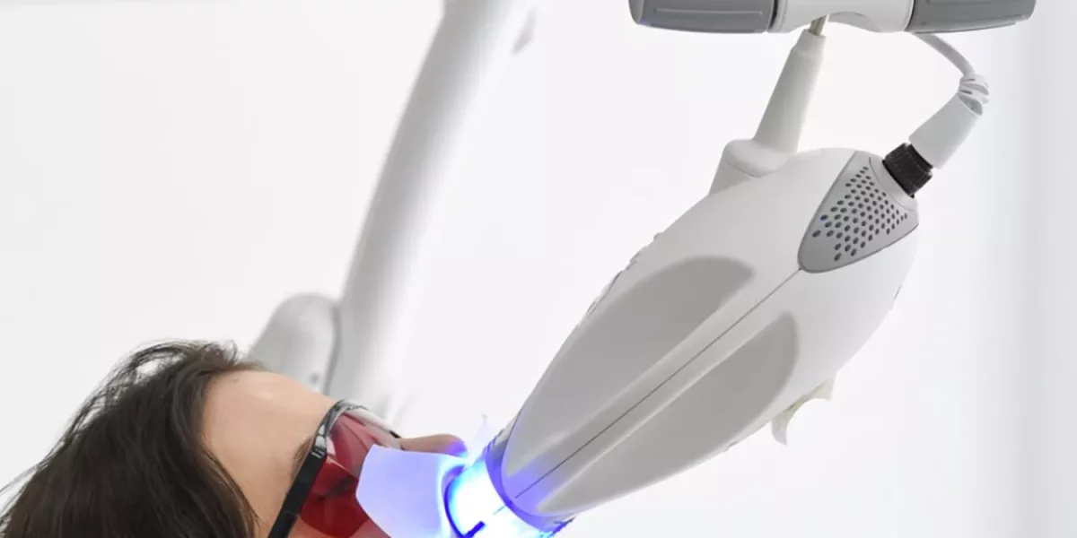 Diş Beyazlatma Güvenle – Gülüşünüzü Beyazlatmadan Önce Bilmeniz Gerekenler