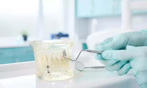 IPR (Interproksimal Redüksiyon): Diş Tıraşlama Gerekli mi? - Milim Dental Hospital