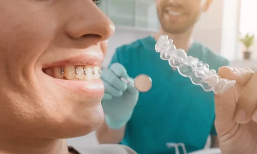 Invisalign'da Ekler (Düğmeler): Ne İşe Yarar ve Neden Gerekli? - Milim Dental Hospital