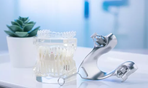 Genişlemeden sonra şeffaf plaklar yardımcı olabilir mi? - Milim Dental Hospital