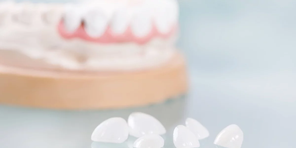 Kaplamalar Ne Kadar Süre Dayanır ve Nasıl Bakım Yapılır?