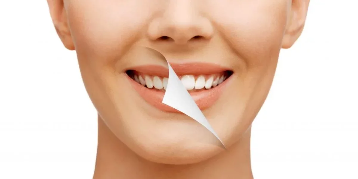 Türkiye'de Gülüş Tasarımı: Milim Dental ile Kendinize Yeniden Güven Kazanın